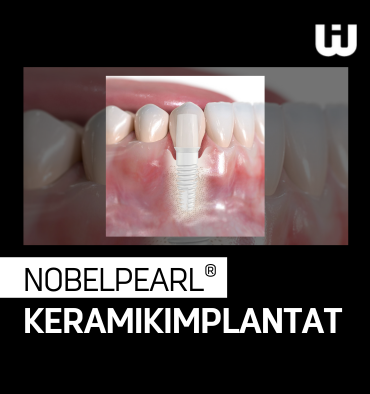 Innovation trifft Kompetenz NOBELPEARL®-KERAMIKIMPLANTAT