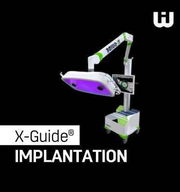 𝐗-𝐆𝐮𝐢𝐝𝐞®